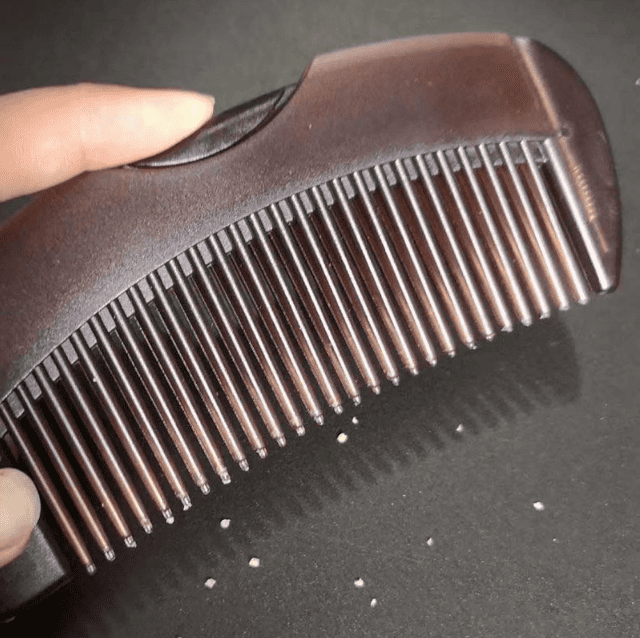 RootCraft | Precision Scalp Refiner