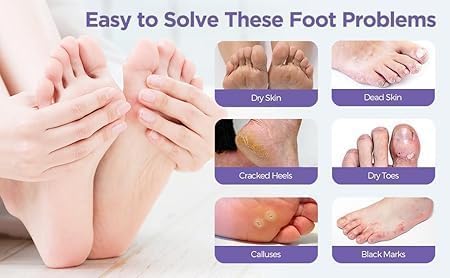 LiveGreater SoftSteps Ritual Set | (Foot exfoliating peel socks)